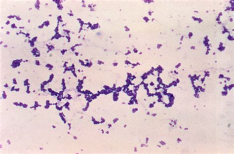 Many Gram Positive Cocci