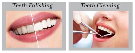 Myth: #Teeth polishing and teeth cleaning are same: Fact: No, Both terminologies are not same ...