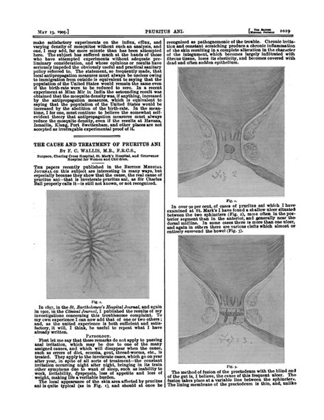 THE CAUSE AND TREATMENT OF PRURITUS ANI | The BMJ