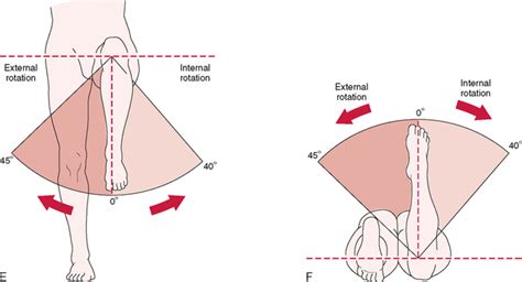 HIP | Musculoskeletal Key