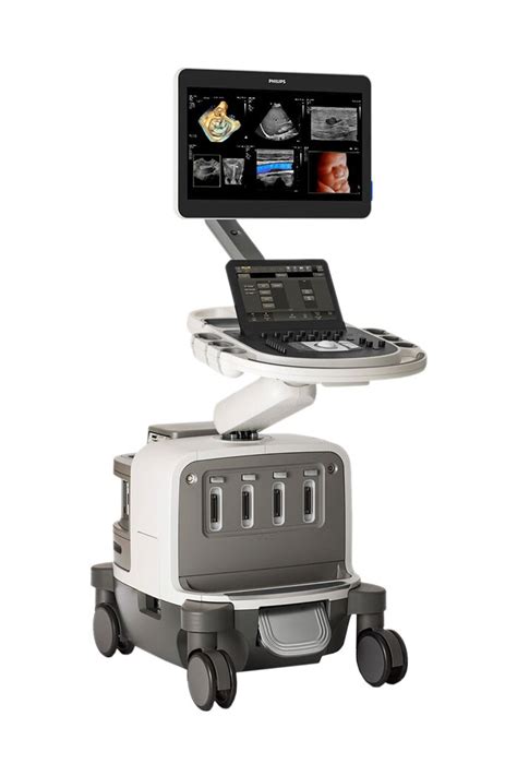 Philips expands ultrasound portfolio with EPIQ Elite - News | Philips