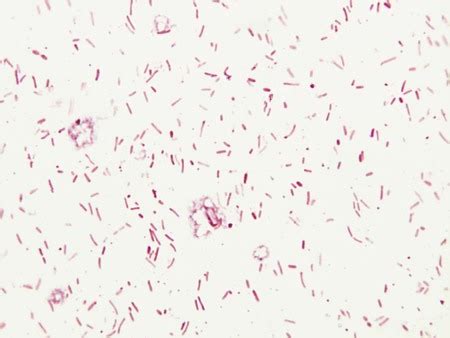 Chromobacterium Violaceum Gram Stain