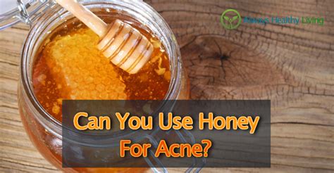 Can You Use Honey For Acne Treatment? - Always Healthy Living