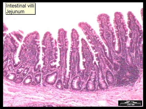 How do villi aid absorption in the small intestine? | Socratic