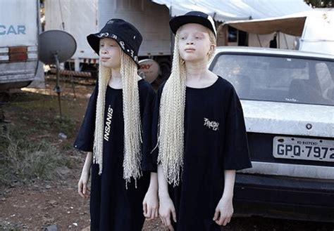 albino-twins-models-lara-mara-brasil