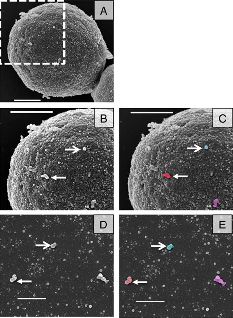 SEM images of acapsular cells shows vesicle-like structures at their... | Download Scientific ...
