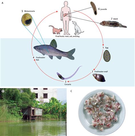 Clonorchiasis - The Lancet