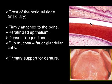 Histology of oral mucous membrane and gingiva