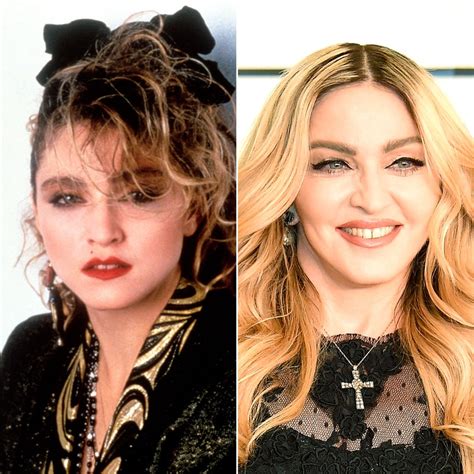 Madonna: How Her Face Has Changed | Us Weekly