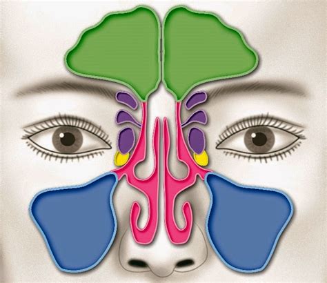 Sinusite Crónica – Definição, Causas, Sintomas, Diagnóstico, Tratamento ...