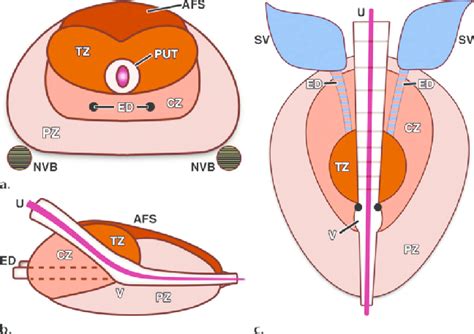 Diagrams show the zonal anatomy of the prostate in the axial (a),... | Download Scientific Diagram