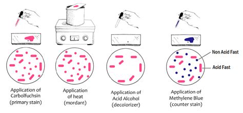 Principle, Procedure, Result Interpretation, Reporting and Modifications of Ziehl-Neelsen Stain ...