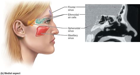 Sinus Infection - Causes, Symptoms, Diagnosis, Treatment & Home Remedies