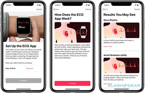 The Apple Watch ECG app is my heart's new best friend - SlashGear