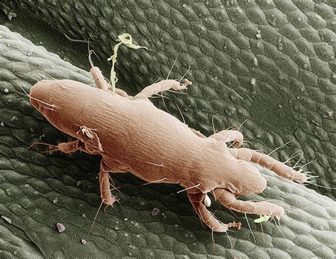 Oak Mites Are Back With A Vengeance In Kansas City | KCUR