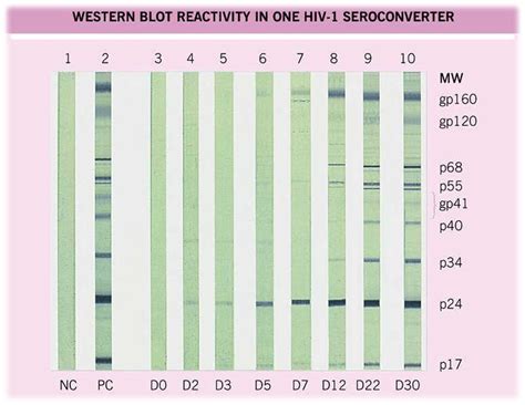 Laboratory diagnosis of HIV Infection • Microbe Online