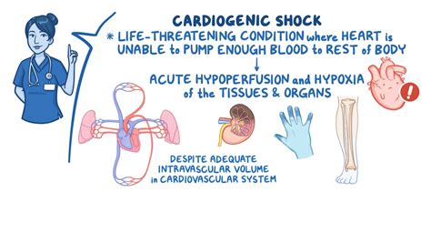 Shock Flashcards - Easy Notecards