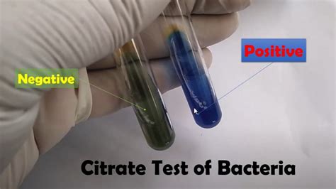 Citrate Test: Principle, Procedure, Result and Interpretation, Citrate Utilizat