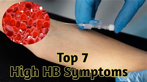 High hemoglobin symptoms - YouTube