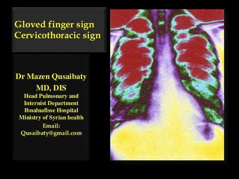 13 Radiology pics ideas | radiology, mri brain, pulmonary embolism survivor