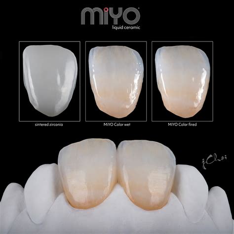 20 Reasons To Love MiYO Liquid Ceramic - Jensen Dental