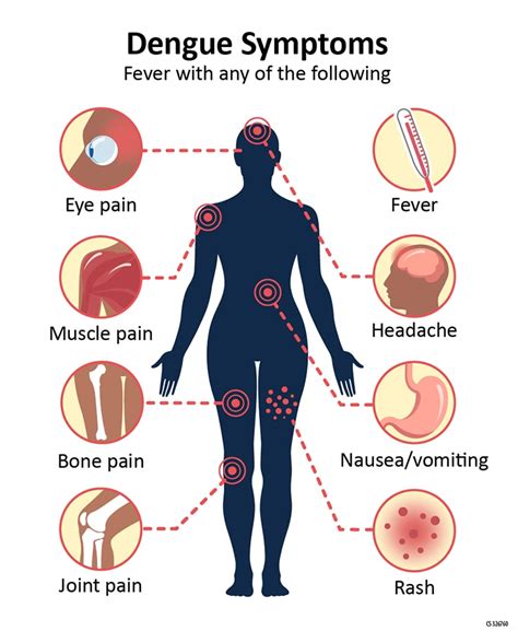 Symptoms and Treatment of Dengue - HEALTH&FITNESS