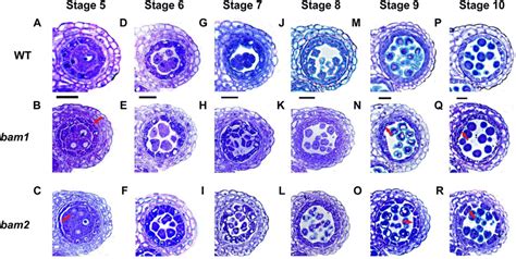 Anther development from stage 5 to stage 10 in the wild type (WT) and ...