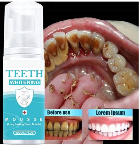 Latibule Mousse Toothpaste Remove Plaque Oral Odor Cleansing teeth Mousse Bright Teeth Teeth ...