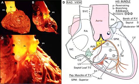 Interventricular Septum Heart