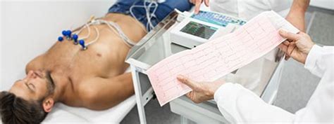 How Is An Ecg Test Performed: A Step-By-Step Guide