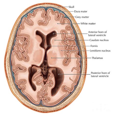 Transverse Section Of The Brain Photograph by Evan Oto