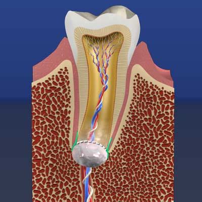 Regenerative Endodontics: Saving Teeth With Stem Cells | School of ...