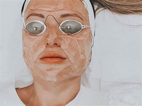 These Are the Best Laser Treatments for Acne Scars