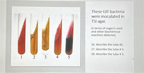 Solved These GIT bacteria were inoculated in TSI agar. In | Chegg.com