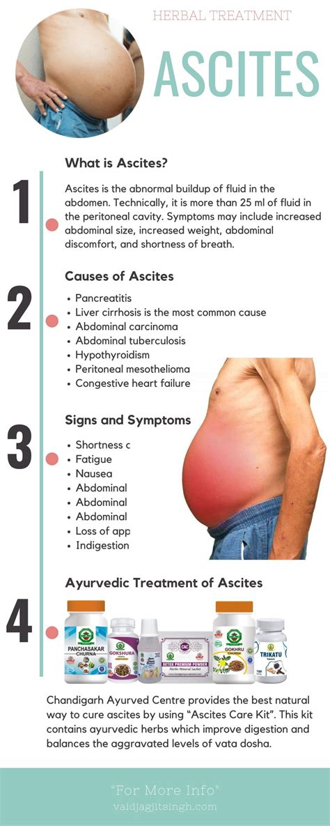 Ascites causes symptoms and herbal treatment – Artofit