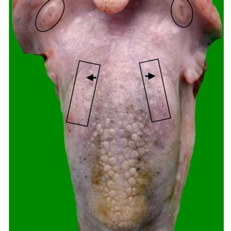 Histological section of the tubal tonsil showing primary and secondary ...