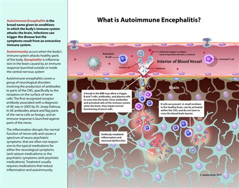 What is Autoimmune Encephalitis? - Jackie Heda | Biomedical & Scientific Visuals