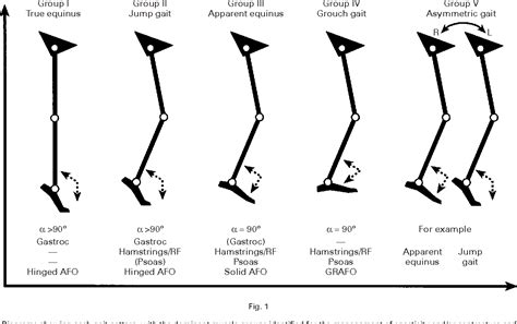 Figure 1 from Sagittal gait patterns in spastic diplegia. - Semantic ...