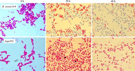 The spore staining results of B. cereus 0–9 and its ΔspoVG mutant.... | Download Scientific Diagram