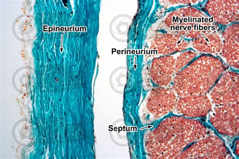 Mammal. Optic nerve. Transverse section. 125X - Optic nerve - Mammals - Mammals - Nervous system ...