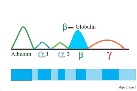 Protein Serum Electrophoresis (Total protein, albumin and globulin ...