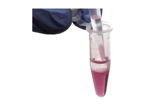 Optimizing RNA Extraction from Cells and Tissues with TRIzol®