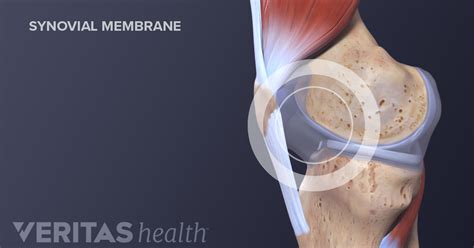 What Is a Synovial Joint?