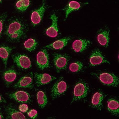 Proteintech™ FlexAble CoraLite™ 488 Antibody Labeling Kit for Rabbit IgG: Home | Fisher Scientific