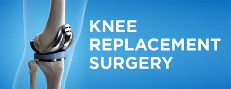 Knee Replacement Surgery: Procedure, Types and Risks | Memon Medical Institute Hospital