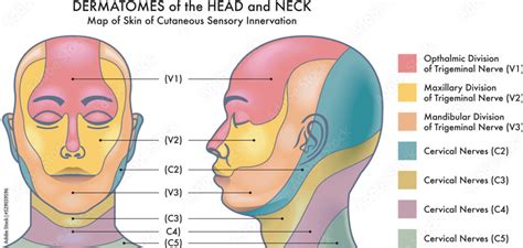 Medical diagram of Dermatomes of the head and neck. vector de Stock ...