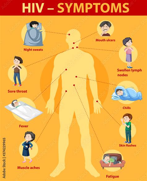 Symptoms of HIV infection infographic Stock Vector | Adobe Stock