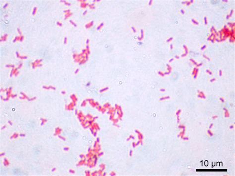 Escherichia coli – Wikipedie