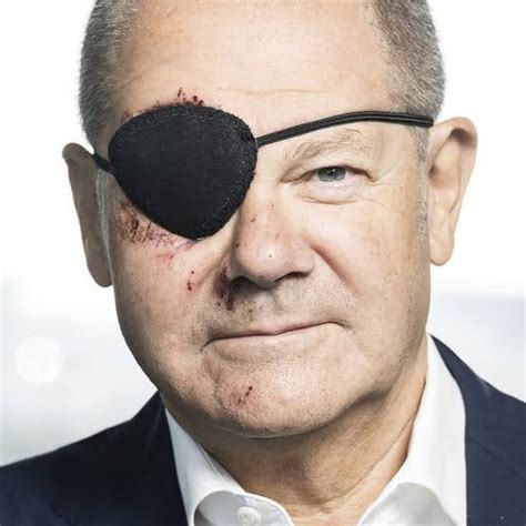 Excited to see the memes’ – German chancellor Olaf Scholz jokes after posting eye patch photo ...