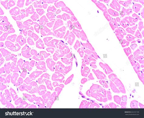 Histology Human Heart Tissue Show Cardiac Stock Photo 632101109 | Shutterstock